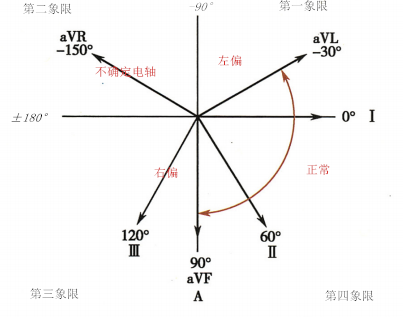 4 种判定心电轴偏移方法 你知道几种 心电视频第6 期 负向