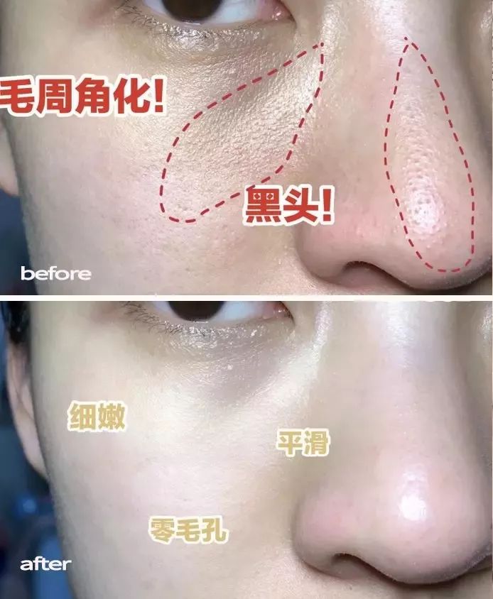 这瓶去角质界的"爱马仕"!