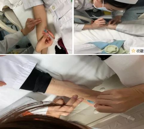 "一针见血"苛刻吗?