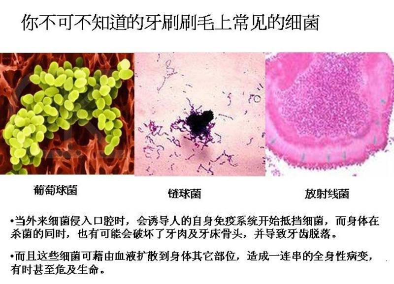 牙刷不消毒细菌赛马桶tflash电动牙刷天天消毒健康无忧