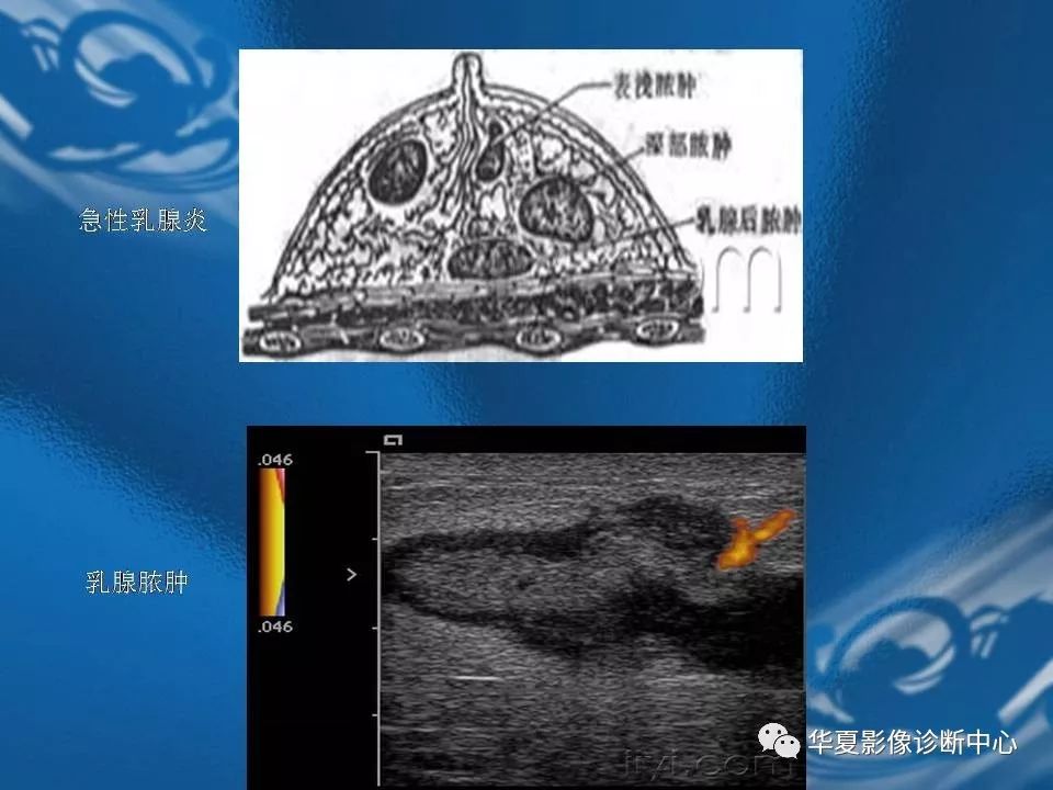 乳腺解剖及常见病变