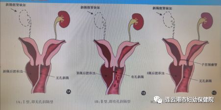 12岁子宫图片