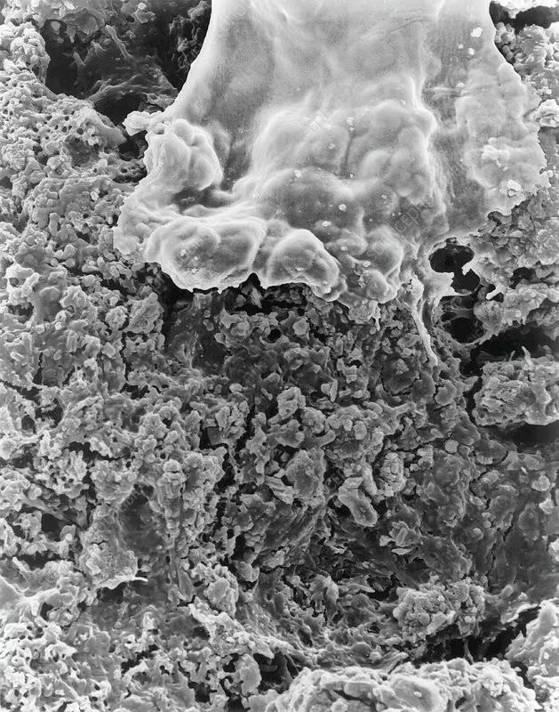 牙菌斑显微镜图片