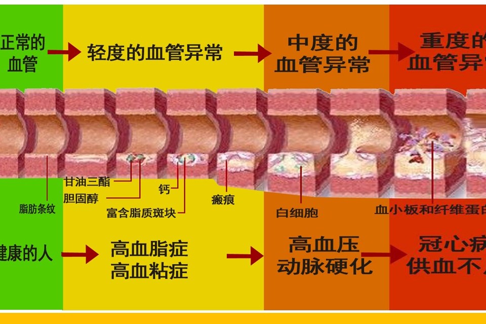 人与血管同寿!快来测测你的血管多大年纪了