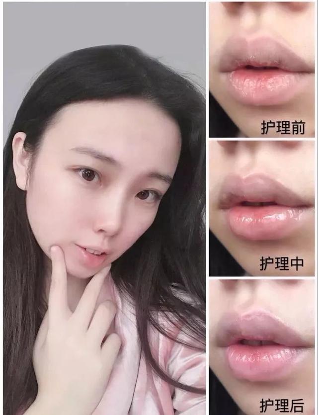 真想知道如何才能擁有李東旭的嘟嘟唇嫩到像打了玻尿酸