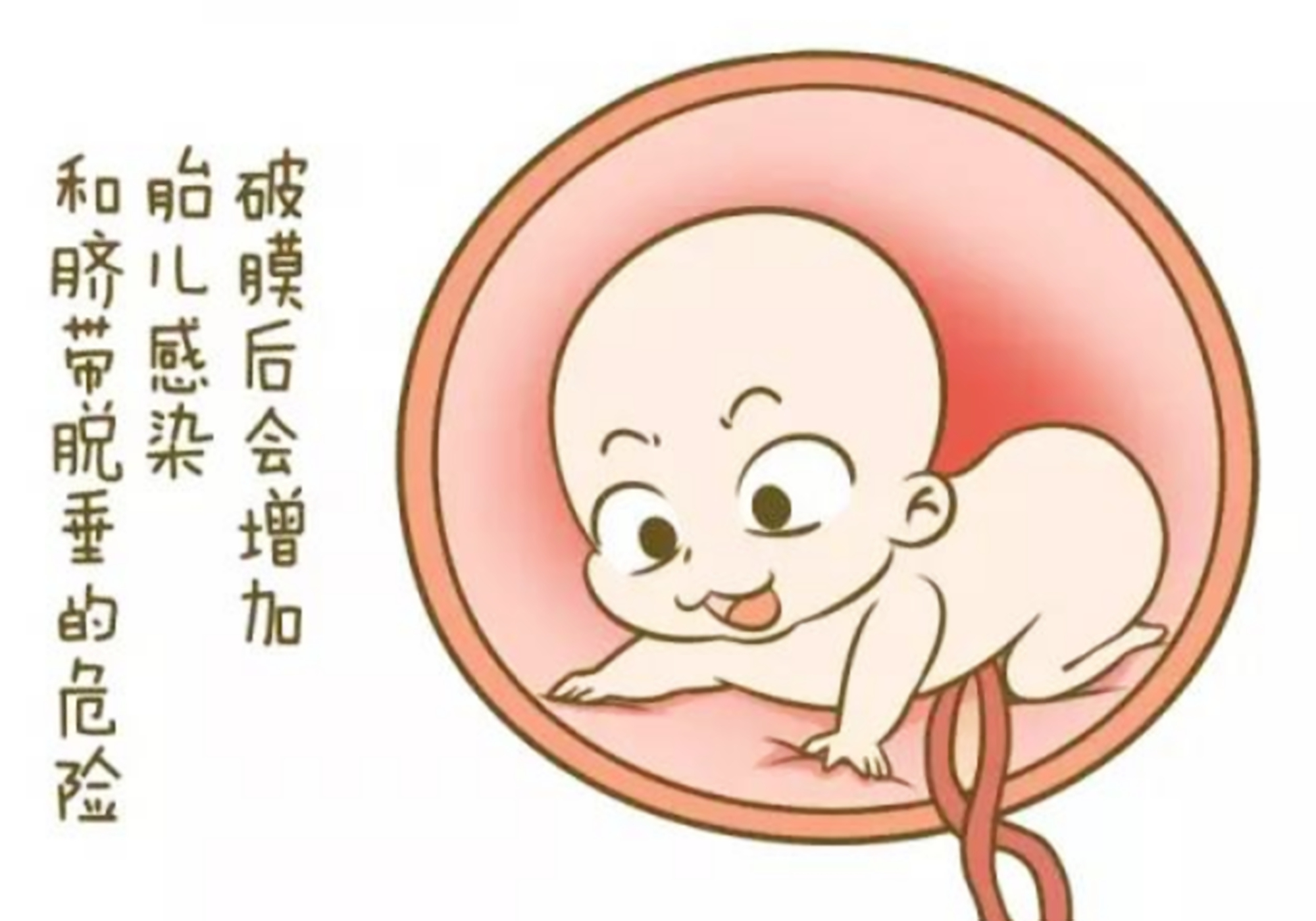 胎膜被宝宝踹破了这种破水方式最尴尬孕妈要早预防