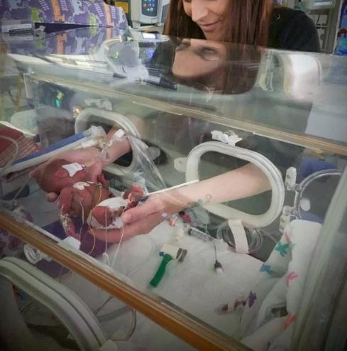 原创英国孕妇生世界最小双胞胎体重让医生感叹生命真的有奇迹