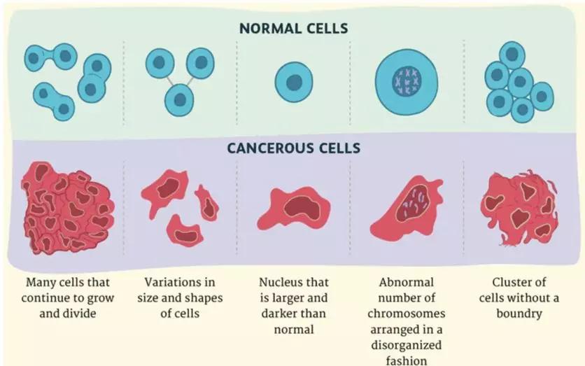 癌细胞和正常细胞有什么差别nk免疫疗法击杀癌细胞