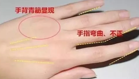 女人的手像棉花一样柔软,享受着好运,但她们很懒