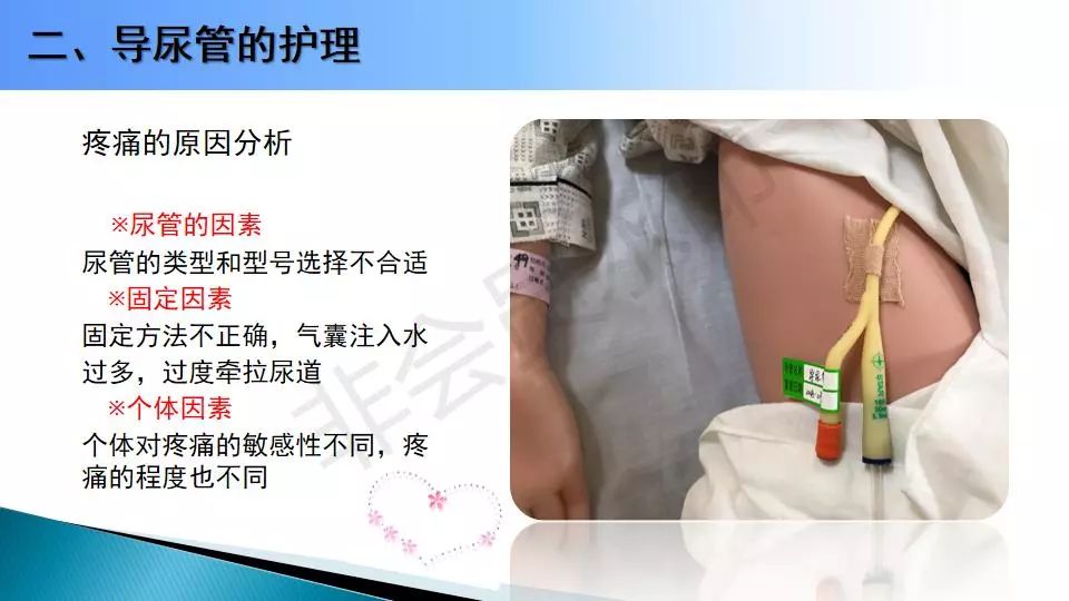 【ppt】引流管的觀察及護理