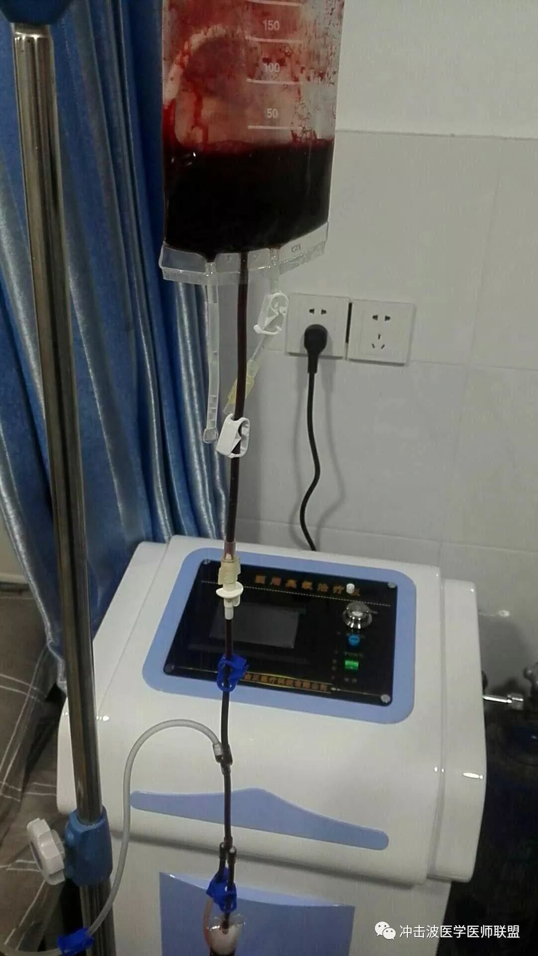 三氧血液净化疗法百病之源的克星