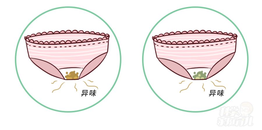 重视冬天才是娃私处感染红屁屁的高发期做好5件事