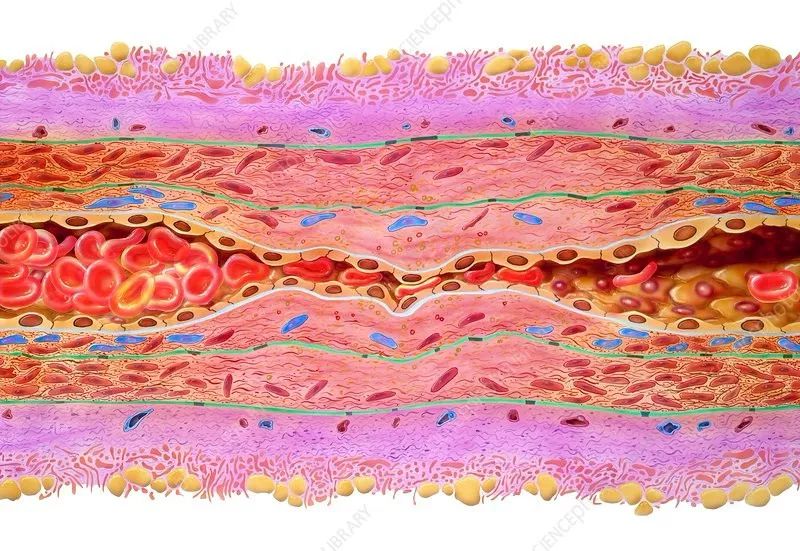 com血管内皮细胞是覆盖于血管最内壁的