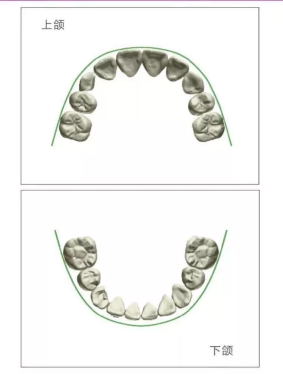 牙弓形态分几种图片图片