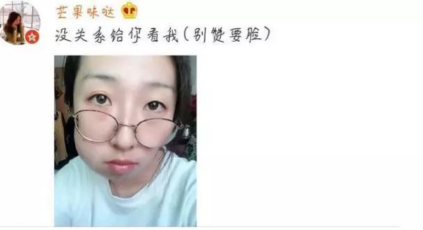 周冬雨拔智齿后面部肿大神似某表情包