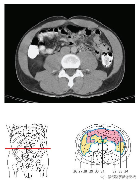 超精细丨腹部断层解剖