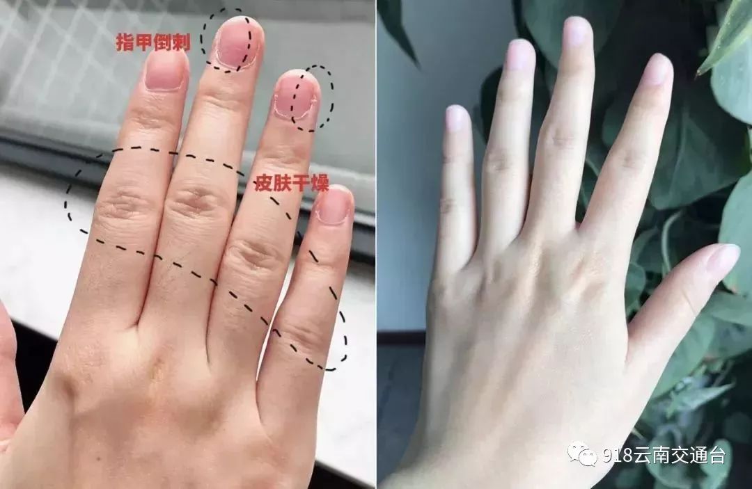 女人一伸手就知道你有没有福气有福的手长这样