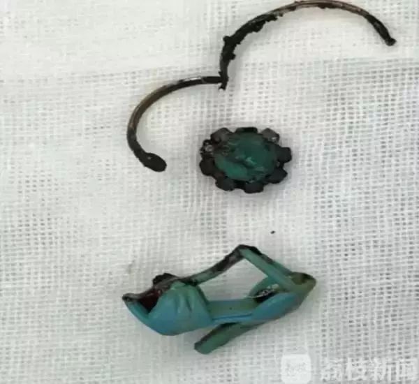 一女孩肚子痛还流血隔了几天走路都不对劲了医生一查竟是下体塞了异物