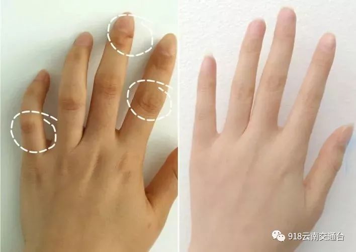 女人一伸手就知道你有没有福气有福的手长这样