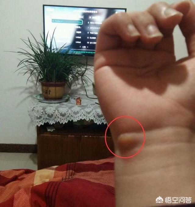 听说打游戏时间长的人手腕都会长成这样你的是不是也这样