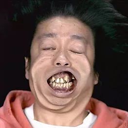 中国人的牙齿也没有那么灾难,但是日本人的牙齿难看是全世界都出了名