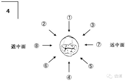 各个牙体雕刻之基本形态要求