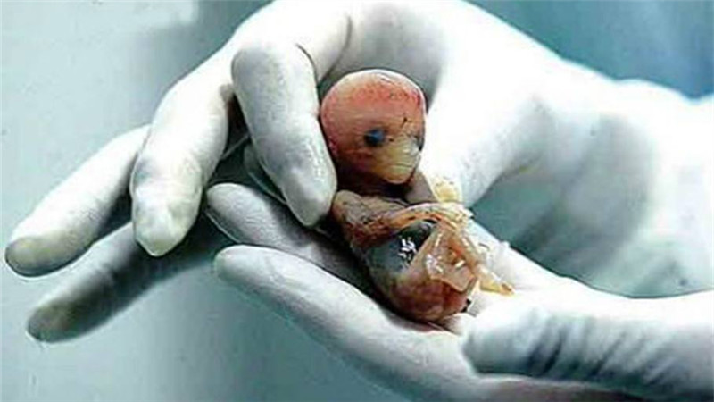 胎儿六十天的高清图图片