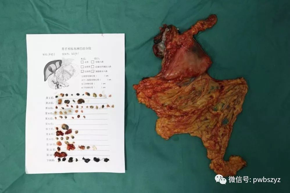 圖說pd1單抗作用機制與胃癌術前臨床應用探索