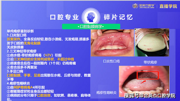 0108每日碎片血管神經性水腫和藥物過敏性口炎的症狀治療你會了嗎