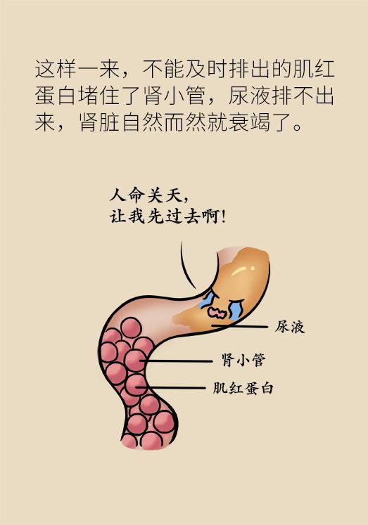 就跑了個步小便咋成褐色的了看好表黃金搶救時間可能還剩6小時