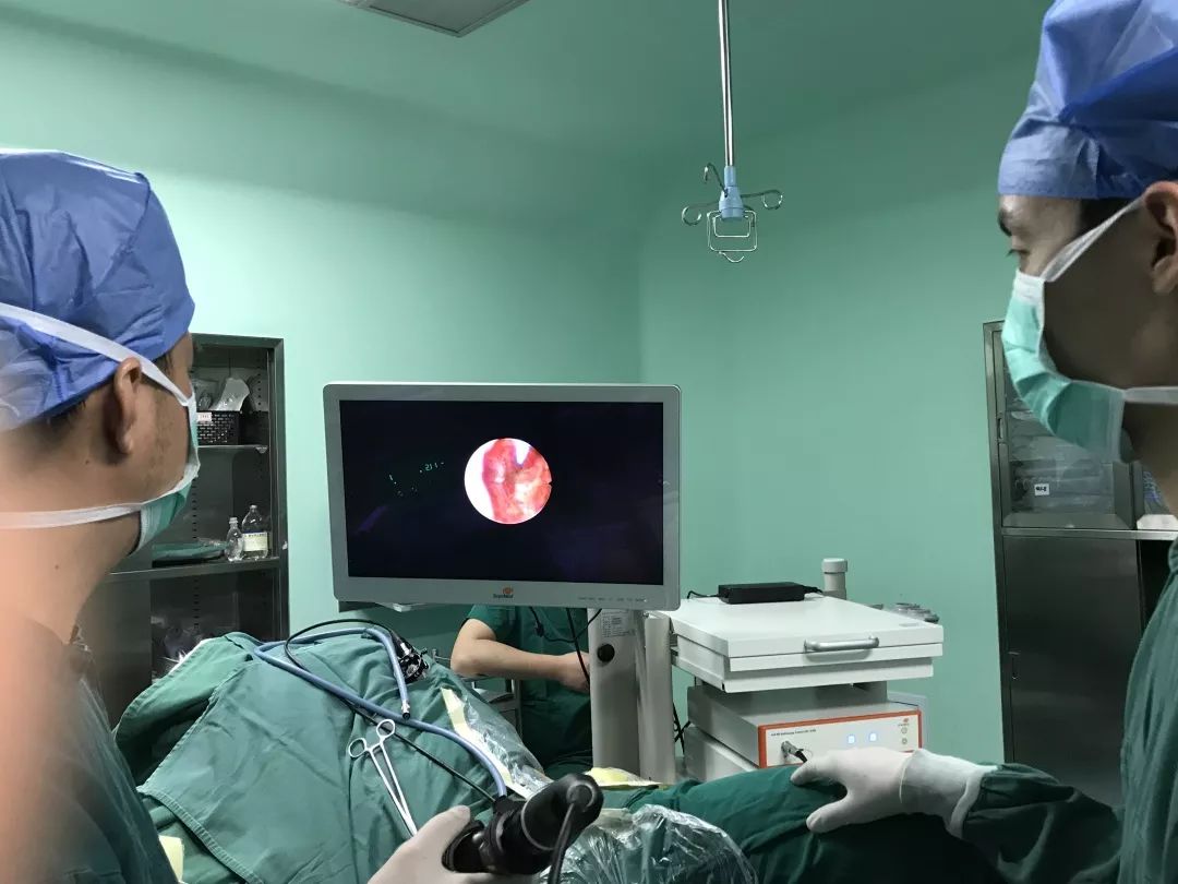 我院泌尿外科团队自制负压吸引装置持续负压状态下软镜硬镜兼施为患者