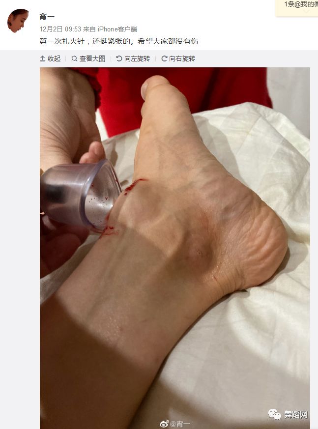 脚部受伤757575朱洁静感慨"舞蹈演员太累太不容易了"舞剧电波