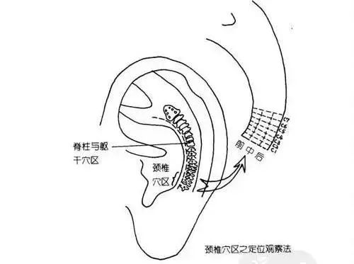 神奇的耳穴疗法降压止痛治失眠