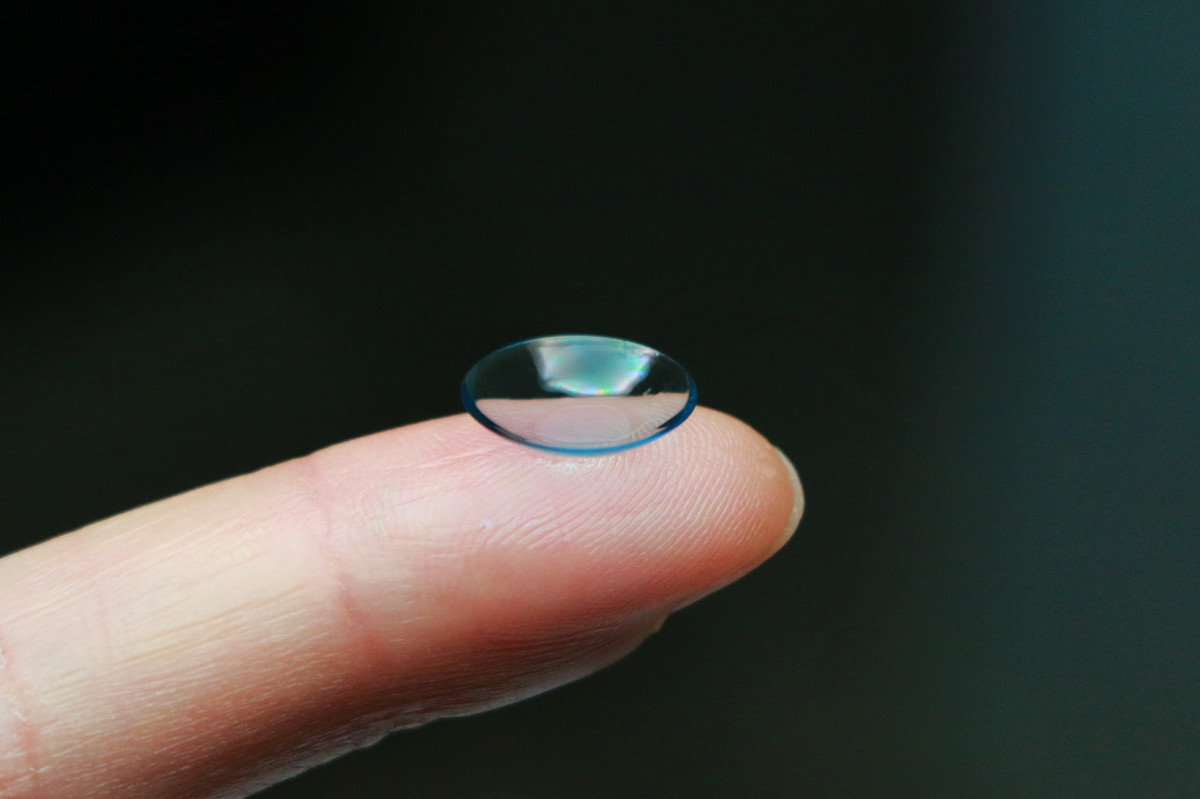 激光近视手术激光近视手术通过激光切削角膜,在角膜上形成一个透镜