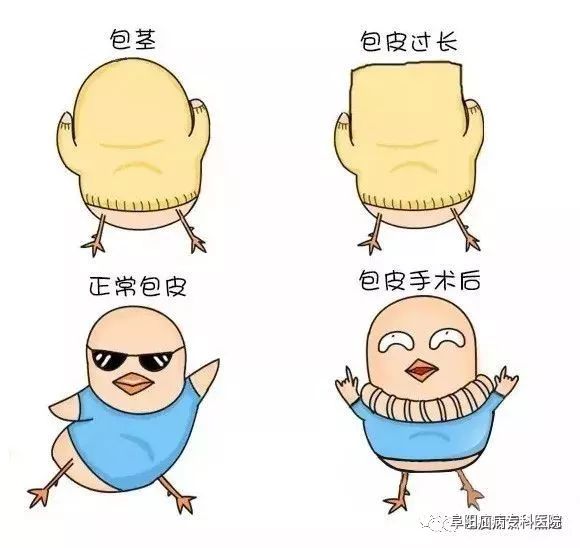 有趣漫画告诉你包皮切or不切麻麻再也不用担心宝宝的小皮出问题了