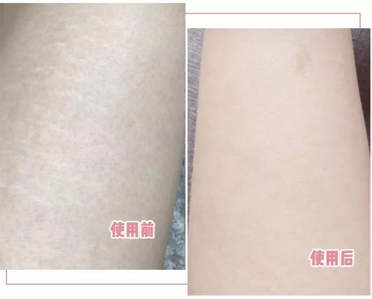 而且天鹅衣里含有胶原蛋白纤维,在它的作用下,皮肤干纹都能得到改善.