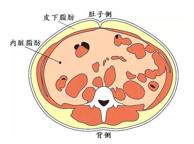 内脏脂肪有多大的危害减掉它们并不难
