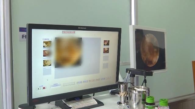 耳内藏14年算盘珠 耳朵有异物怎么取出来?