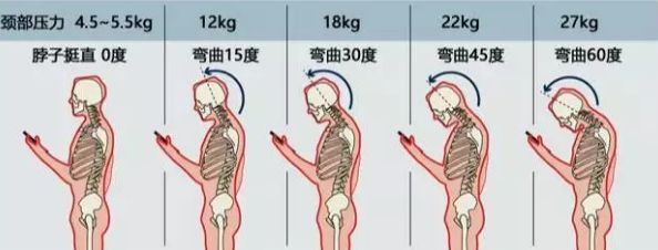 前倾呈60°角时,颈椎承重可达54斤.