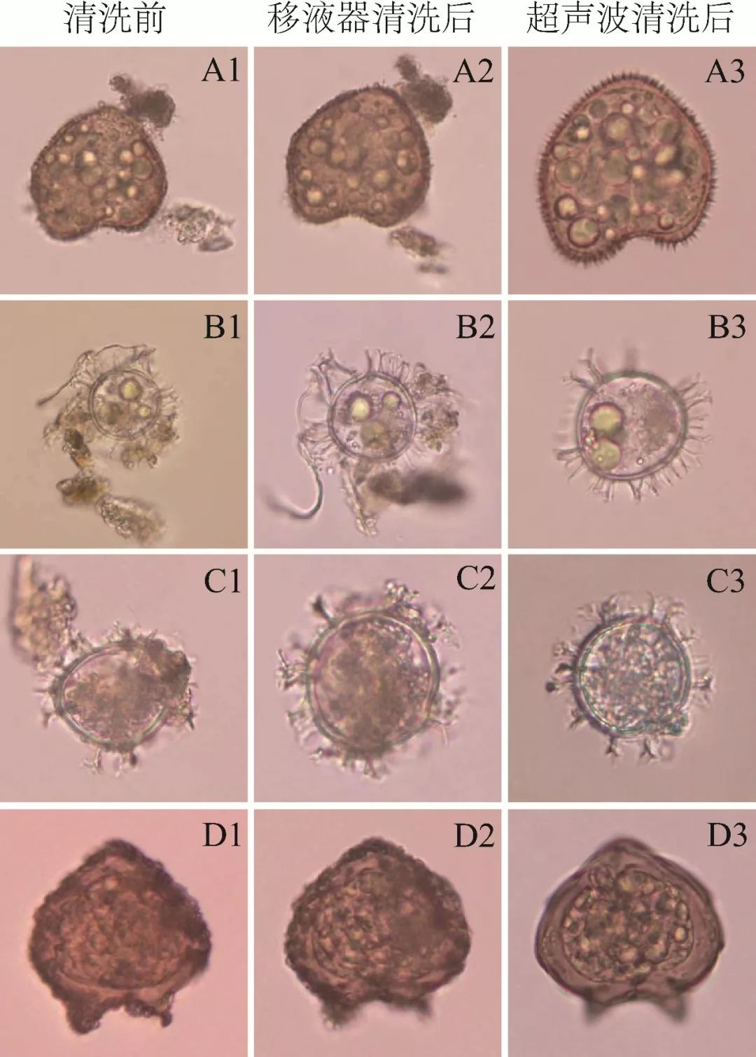 甲藻孢囊是引发甲藻赤潮的种源,但其个体微小,形态鉴定高度依赖技术