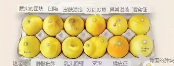 酒窝征乳房图片