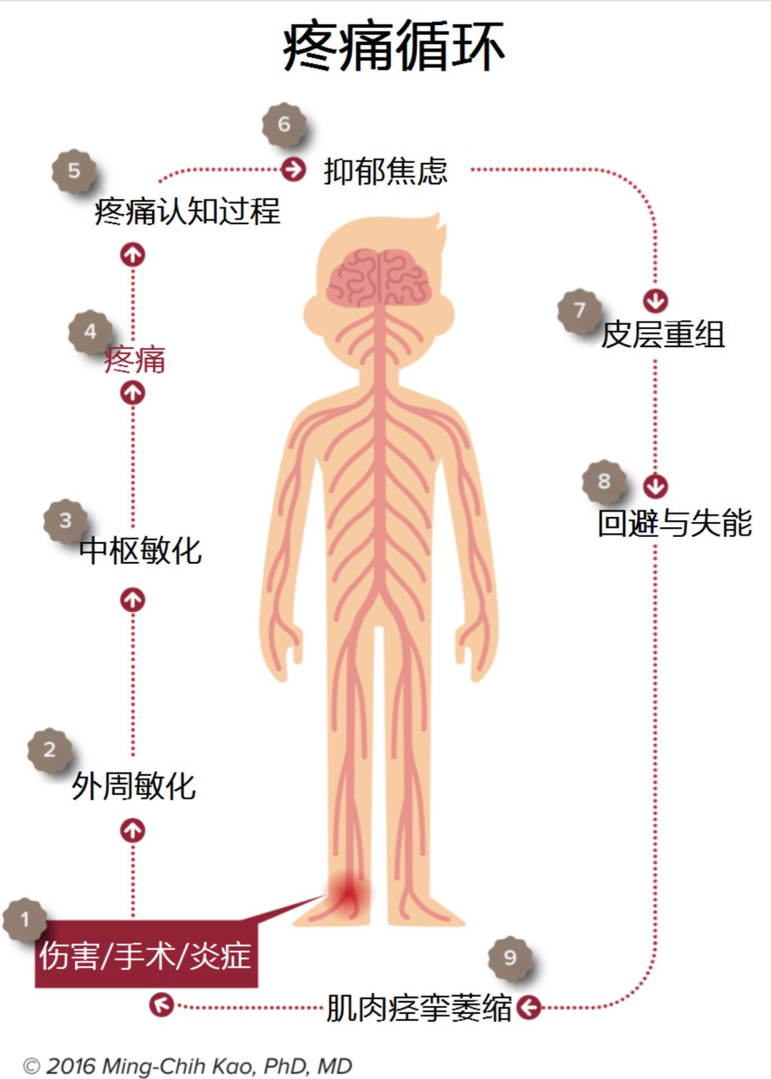 影响疼痛的因素图片