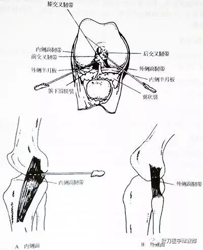 详解臀大肌及针刀治疗附送针刀临床中肌肉功能作用