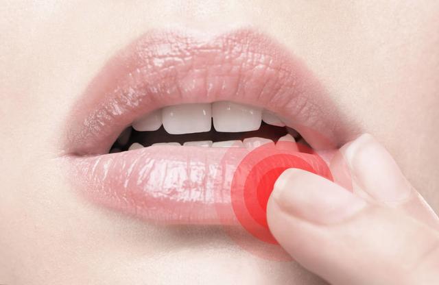 嘴唇干裂不是因为缺水病根在这里