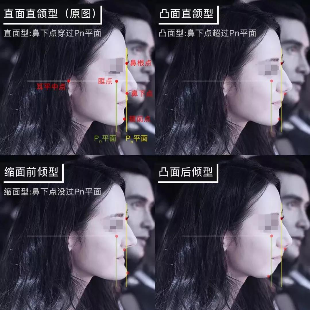 每种面型又可分为三类共九种.