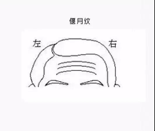 男克妻,女剋夫 你頭上是否有這條紋?