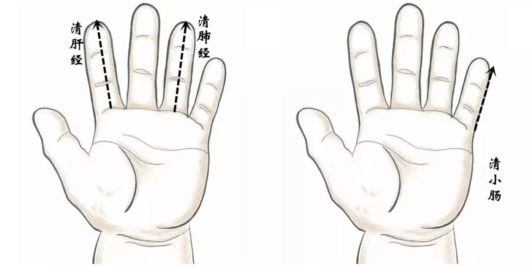 如何区别对待孩子尿床这件事