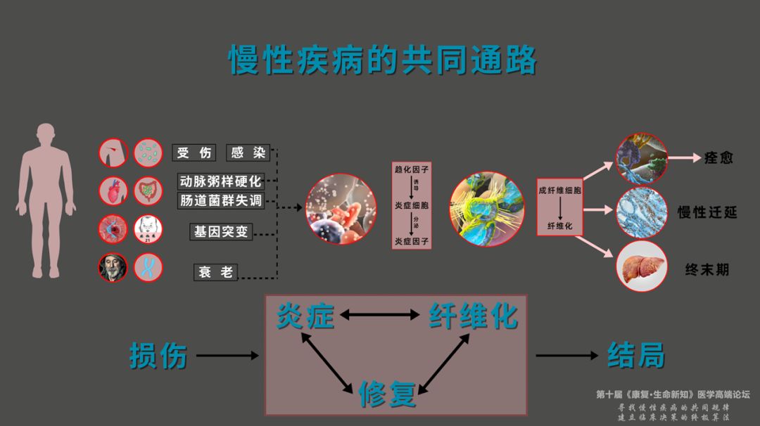 尋找慢性疾病的共同規律_治療