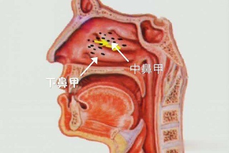 首大崔付军导致鼻甲肥大的原因都有哪些日常要如何保养