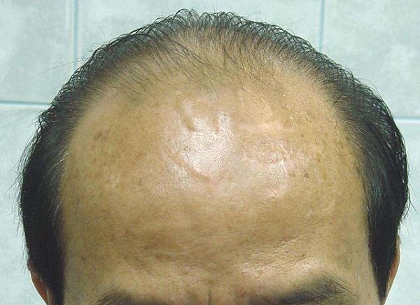 这4种"遗传性"疾病,只传男不传女,夫妻备孕前最好检查一下_基因